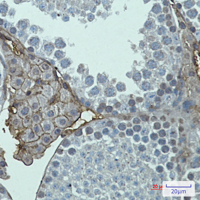 Metabotropic Glutamate Receptor 2 Rabbit Monoclonal Antibody