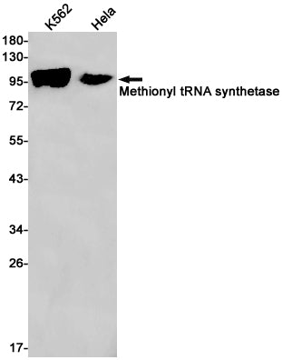 MetRS Rabbit Monoclonal Antibody