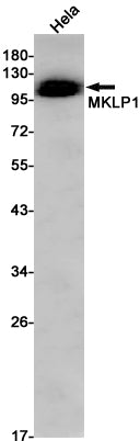 MKLP1 Rabbit Monoclonal Antibody