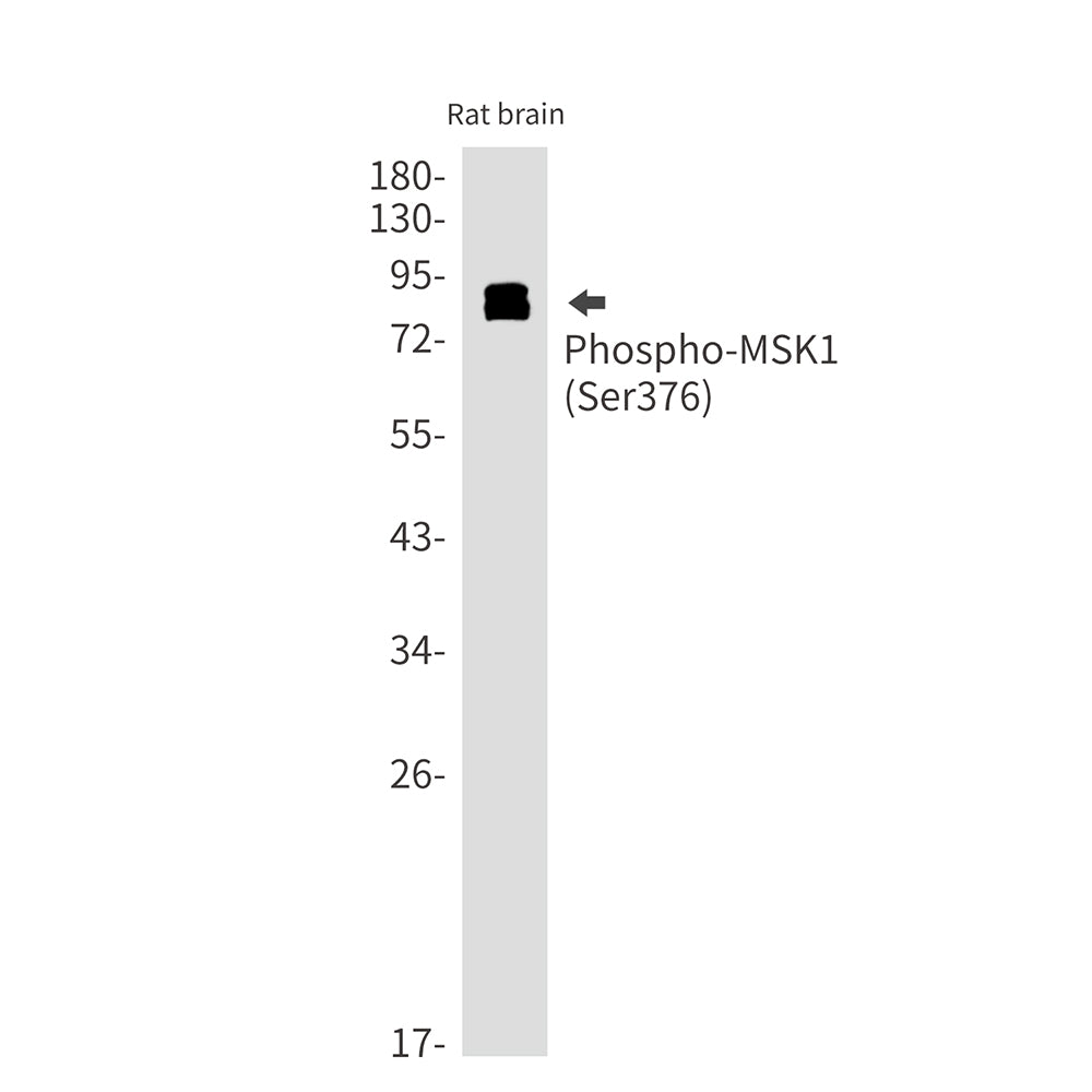 Phospho-MSK1 (Ser376) Rabbit Monoclonal Antibody