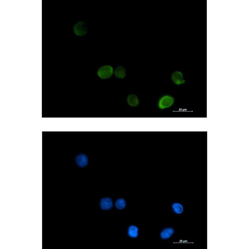 MTHFR Rabbit Monoclonal Antibody