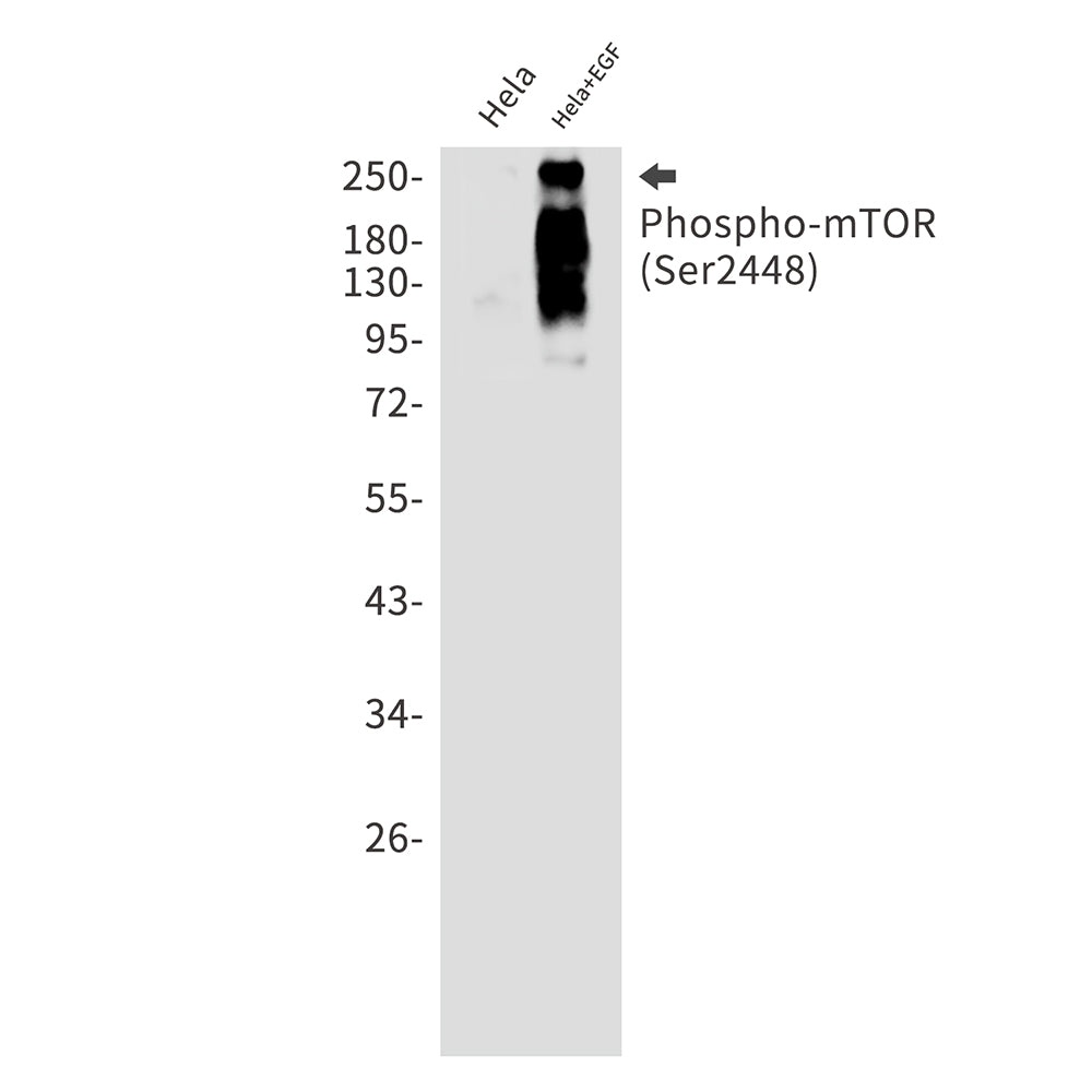 Phospho-mTOR (Ser2448) Rabbit Monoclonal Antibody
