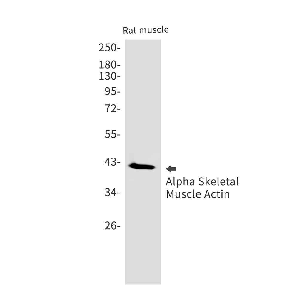 alpha Skeletal Muscle Actin Rabbit Monoclonal Antibody