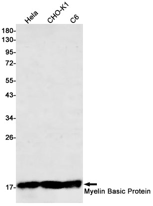Myelin Basic Protein Rabbit Monoclonal Antibody