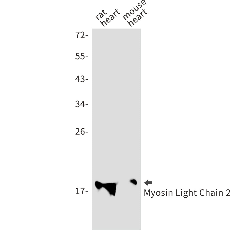 MYL2 Rabbit Monoclonal Antibody