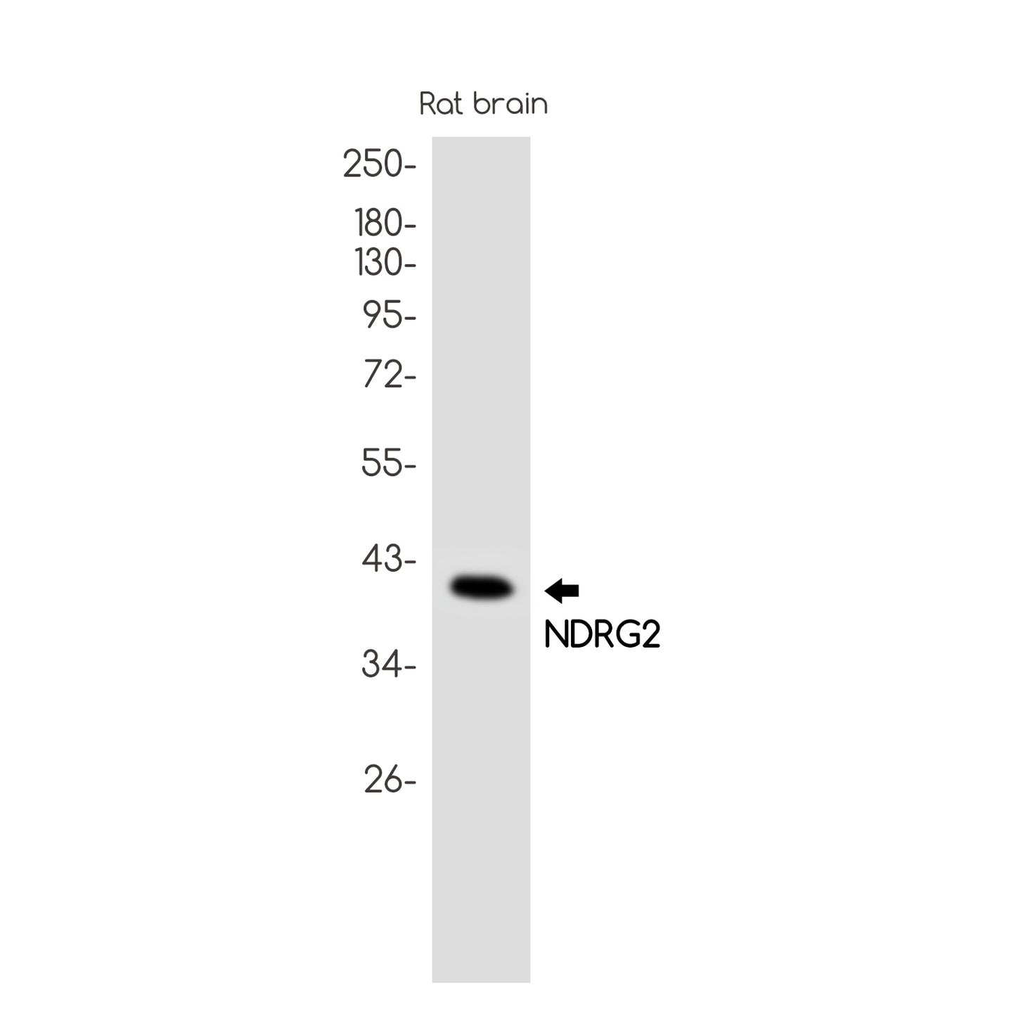 NDRG2 Rabbit Monoclonal Antibody