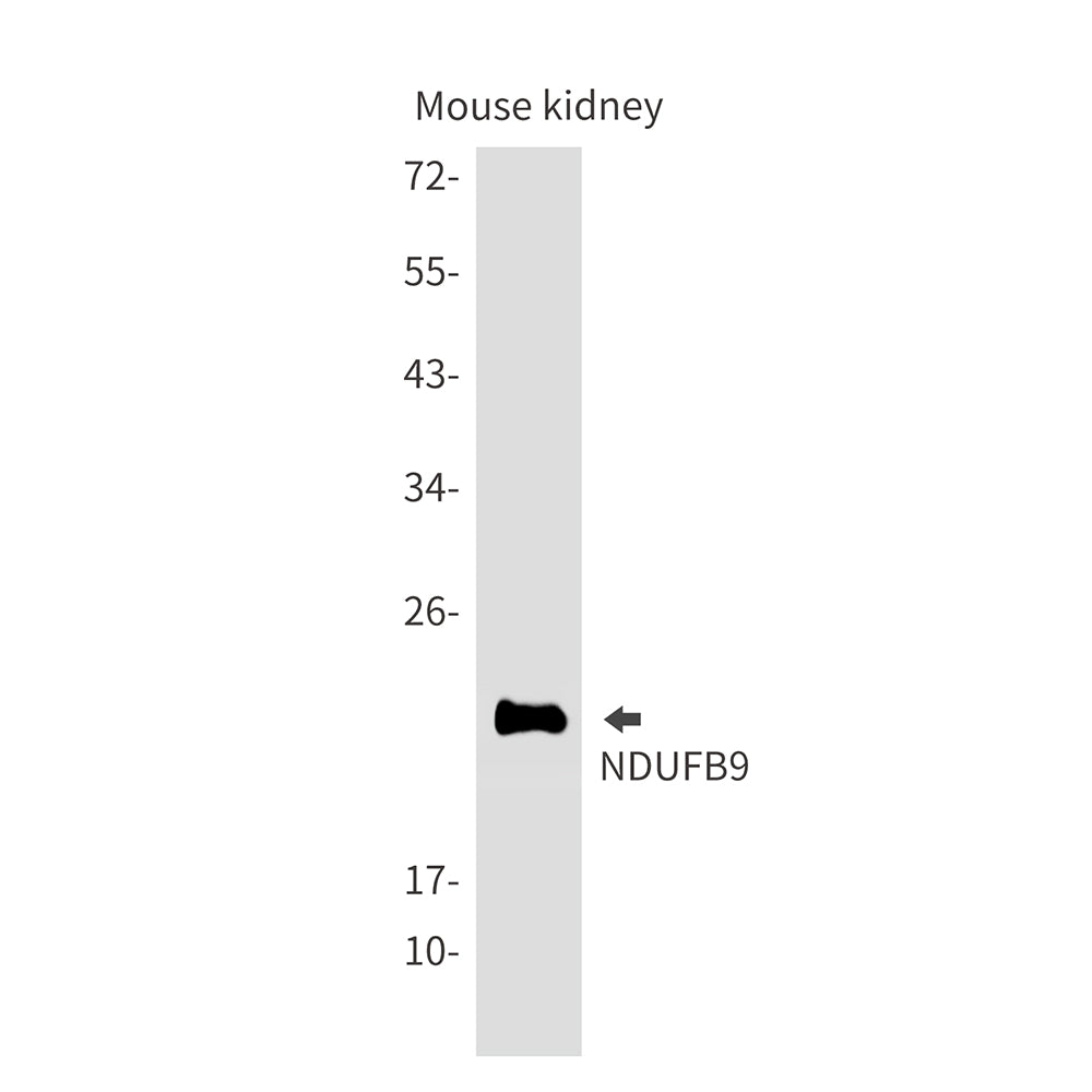NDUFB9 Rabbit Monoclonal Antibody