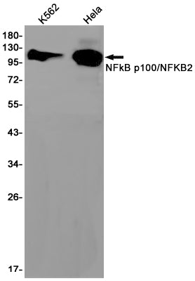 NF-KB p100 Rabbit Monoclonal Antibody