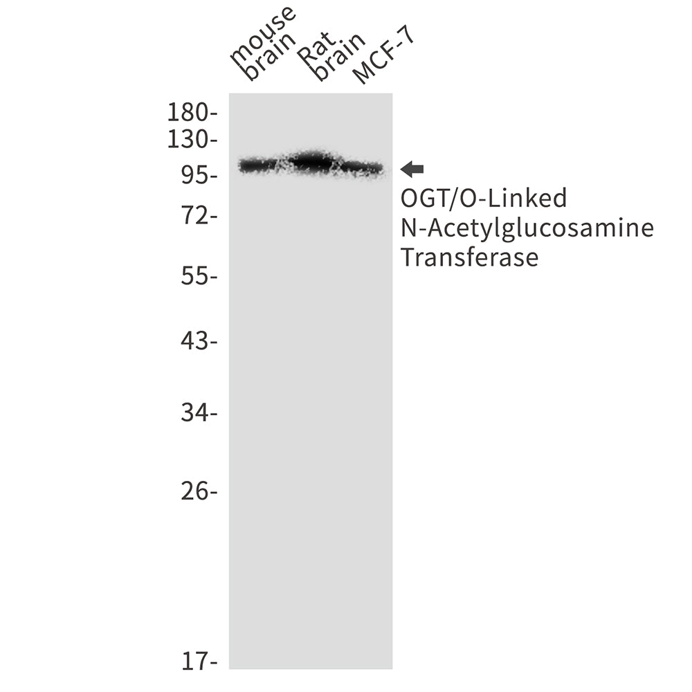 OGT Rabbit Monoclonal Antibody