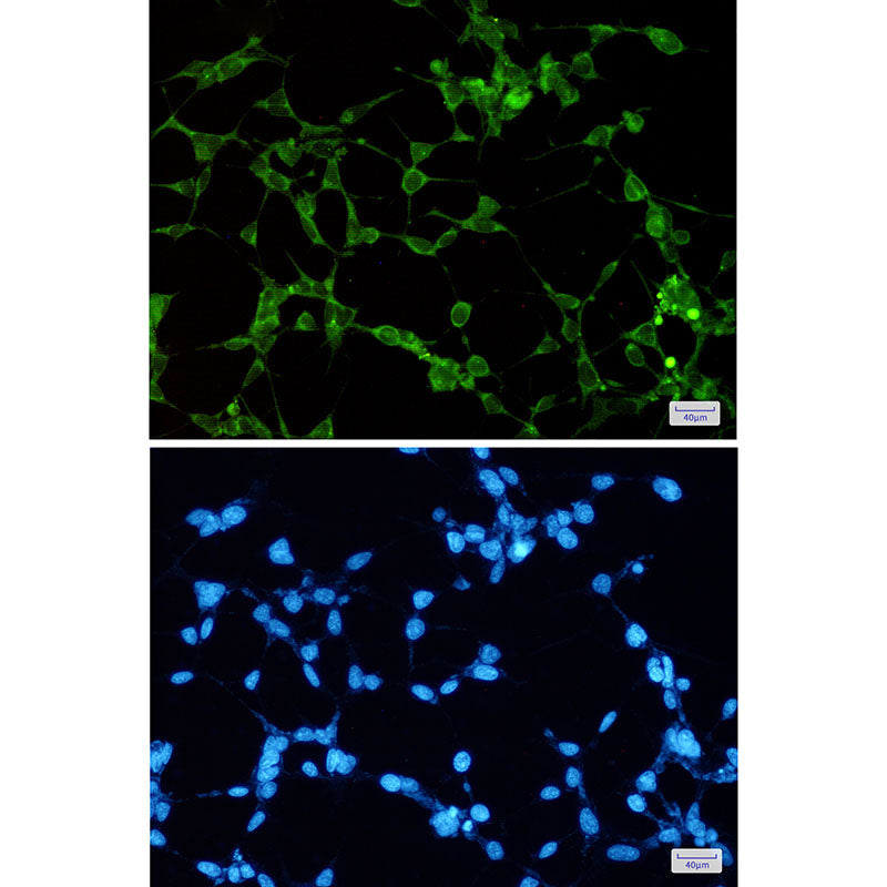 ORP1 Rabbit Monoclonal Antibody