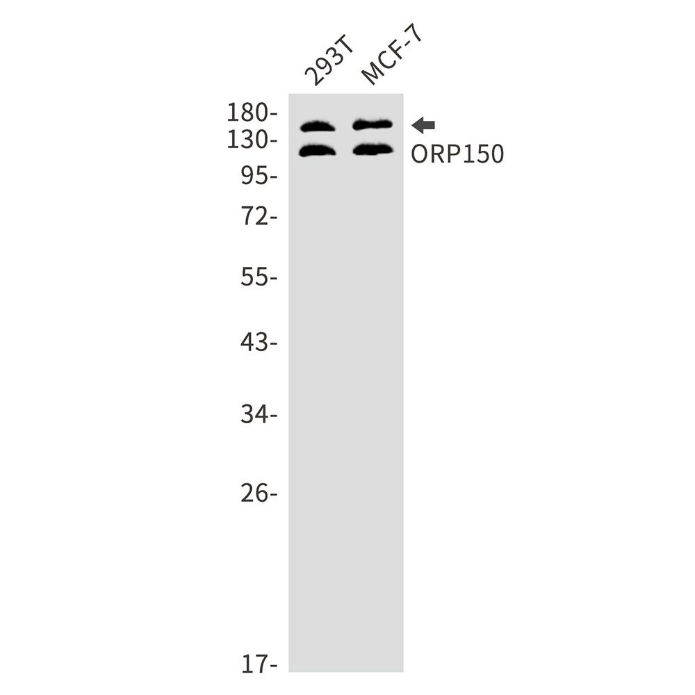 ORP150 Rabbit Monoclonal Antibody