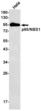 Nibrin Rabbit Monoclonal Antibody