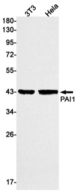 PAI1 Rabbit Monoclonal Antibody
