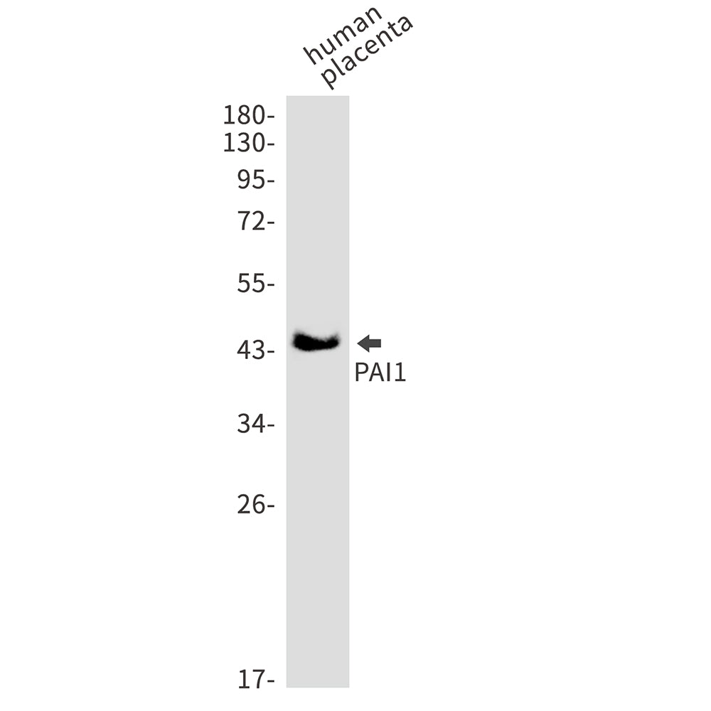 PAI1 Rabbit Monoclonal Antibody