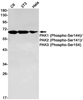 Phospho-PAK1/2/3 (Ser144/Ser141/Ser154) Rabbit Monoclonal Antibody