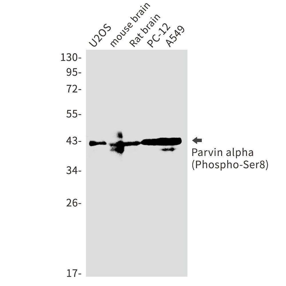 Phospho-Parvin alpha (Ser8) Rabbit Monoclonal Antibody