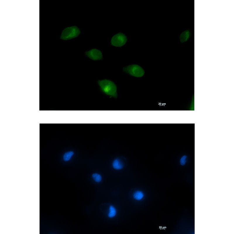 PCK2 Rabbit Monoclonal Antibody