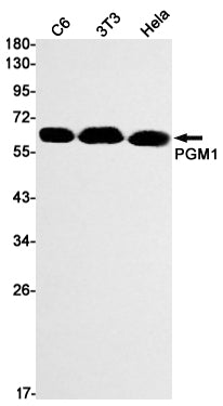 PGM1 Rabbit Monoclonal Antibody