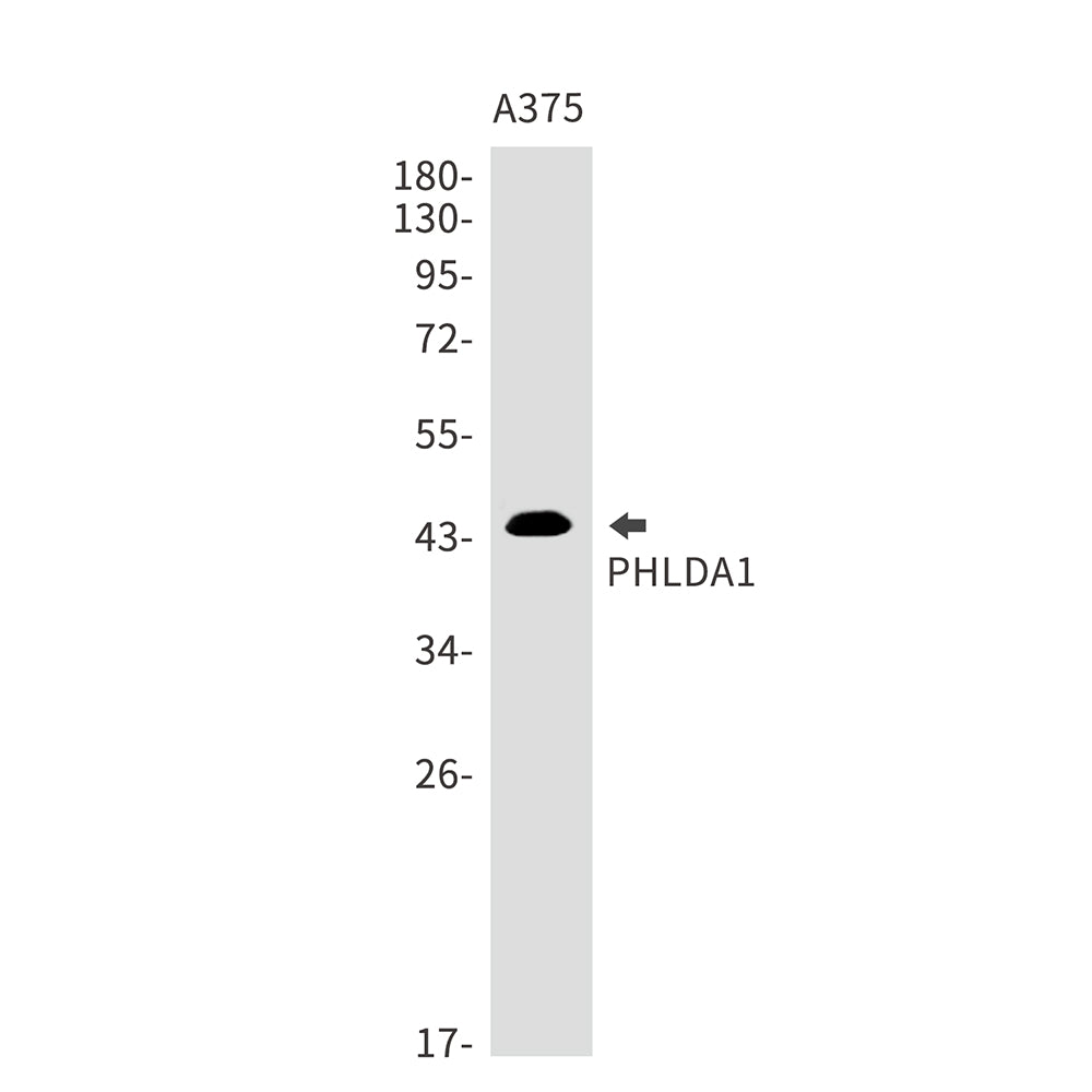 PHLDA1 Rabbit Monoclonal Antibody