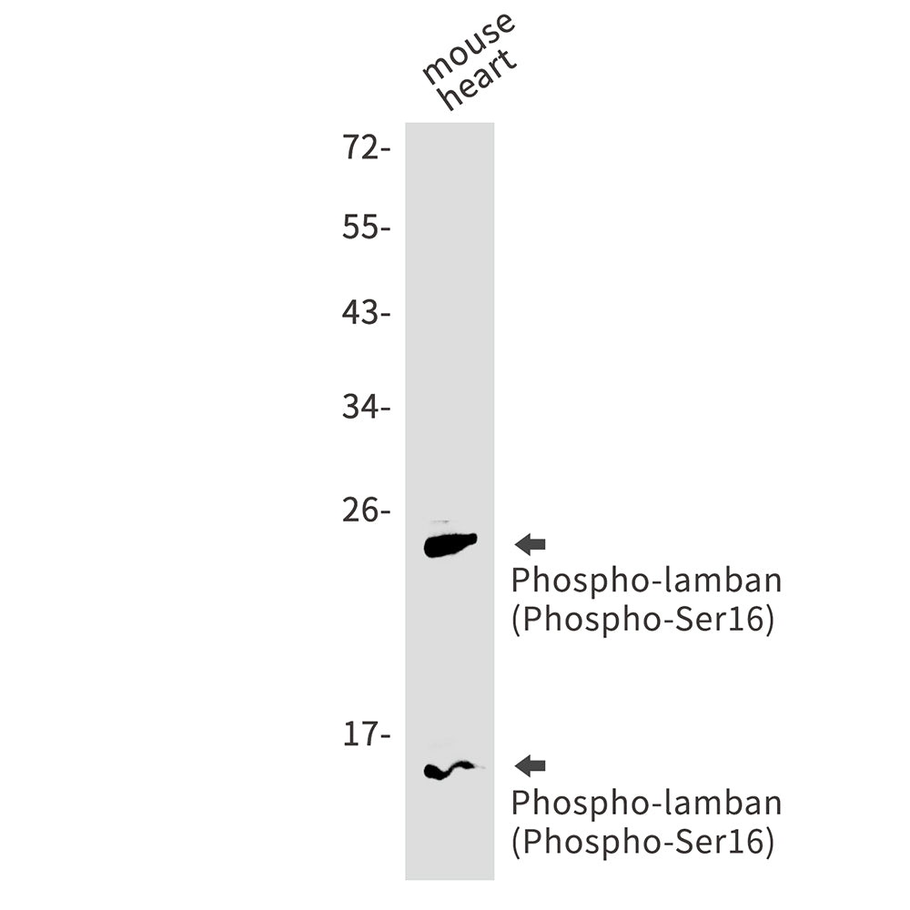 Phospho-Phospholamban (Ser16) Rabbit Monoclonal Antibody