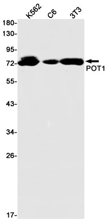 POT1 Rabbit Monoclonal Antibody