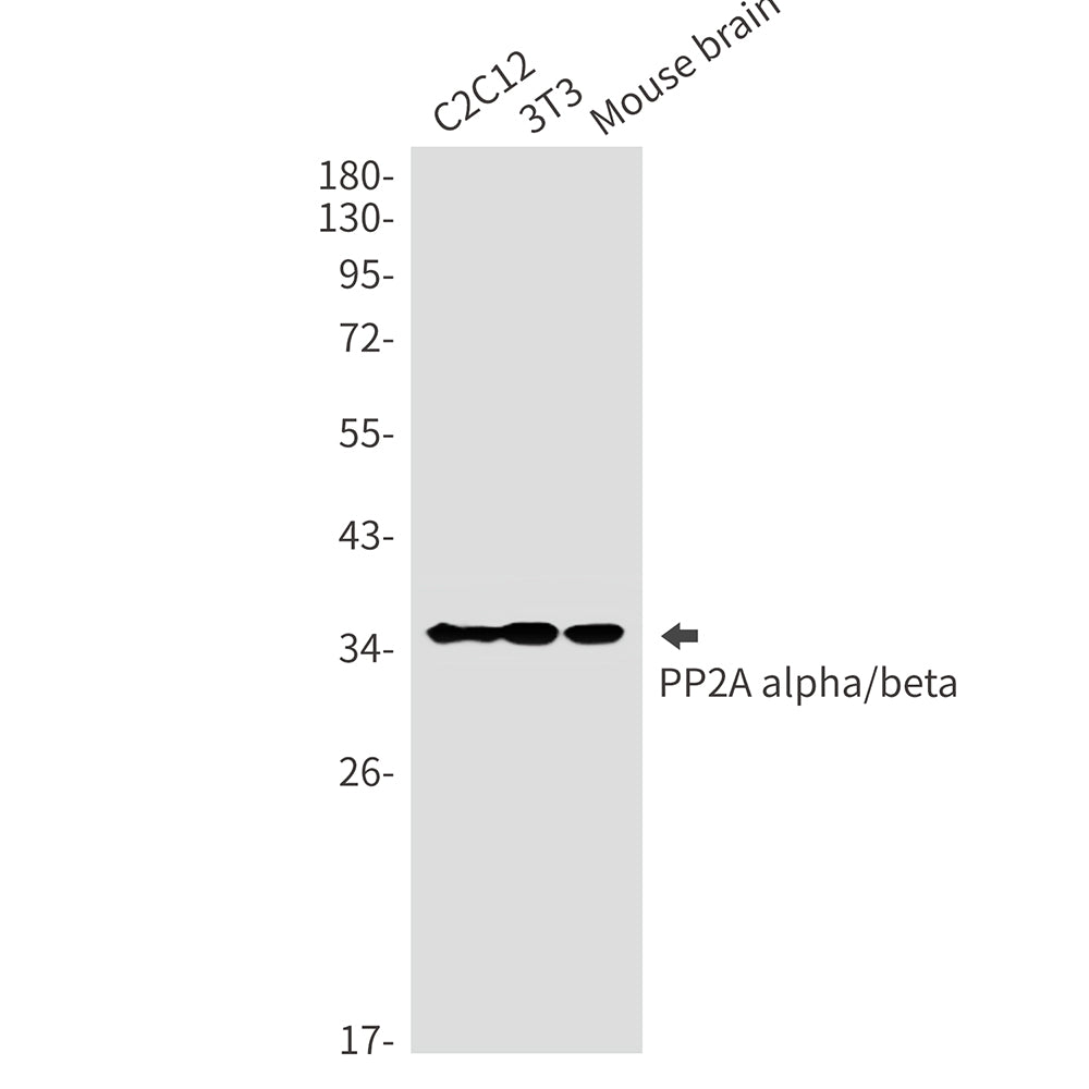 PP2A alpha/beta Rabbit Monoclonal Antibody