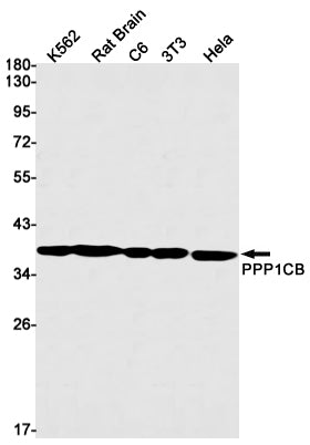 PP1C beta Rabbit Monoclonal Antibody