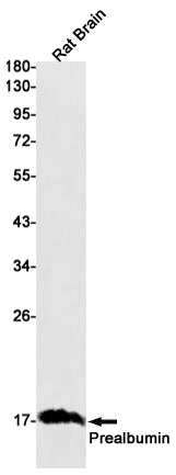 Prealbumin Rabbit Monoclonal Antibody