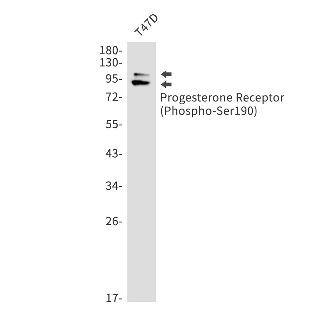 Phospho-Progesterone Receptor (Ser190) Rabbit Monoclonal Antibody