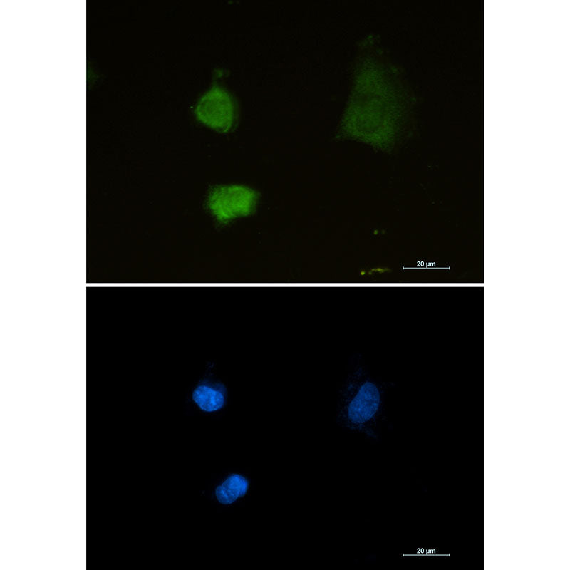Proteasome alpha 2 Rabbit Monoclonal Antibody