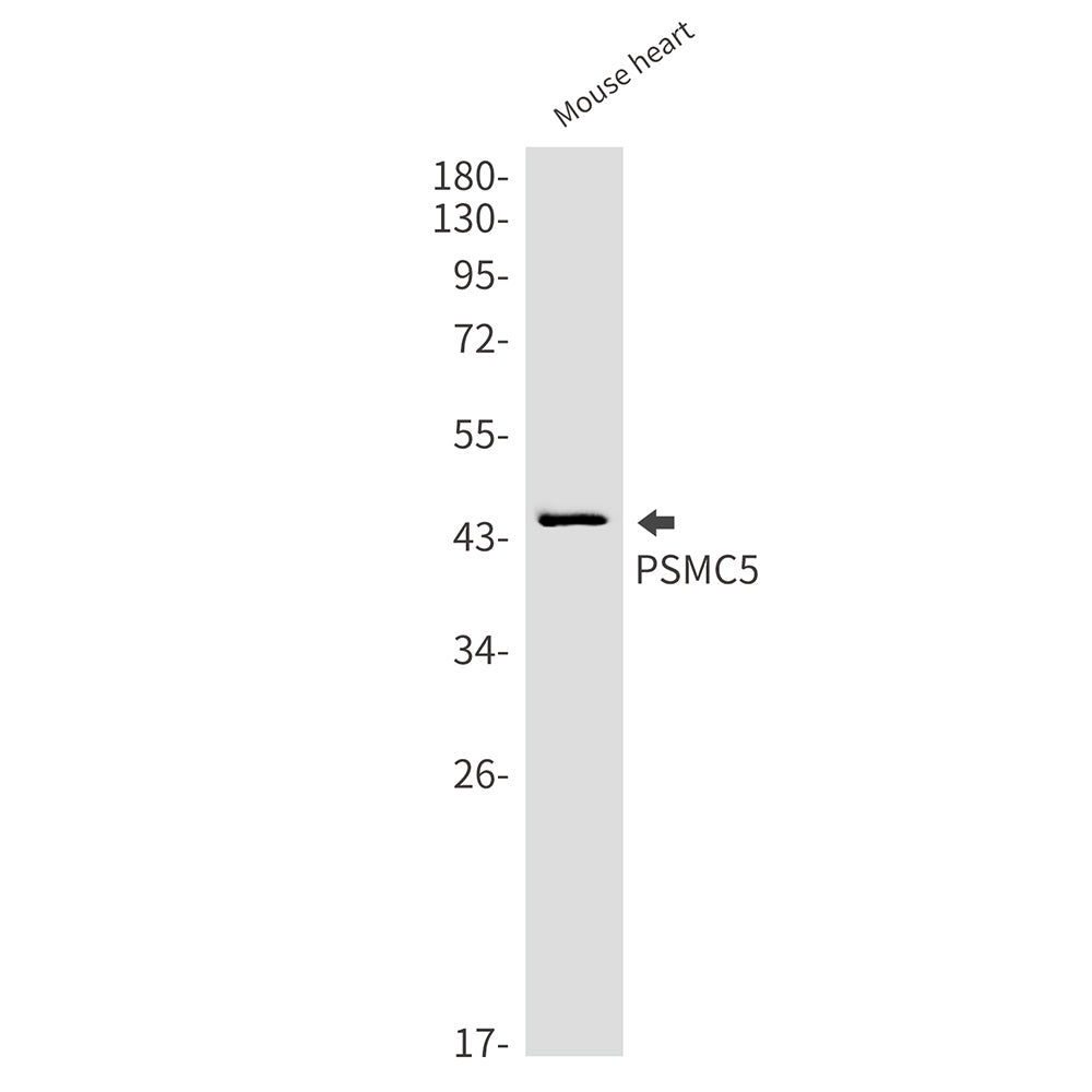 PSMC5 Rabbit Monoclonal Antibody