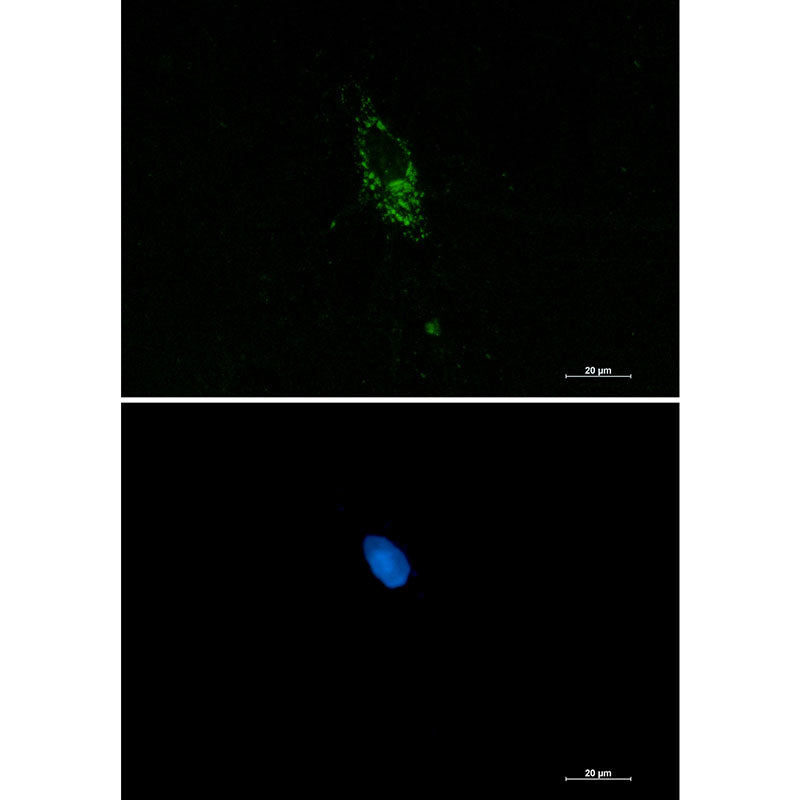 PUM1 Rabbit Monoclonal Antibody