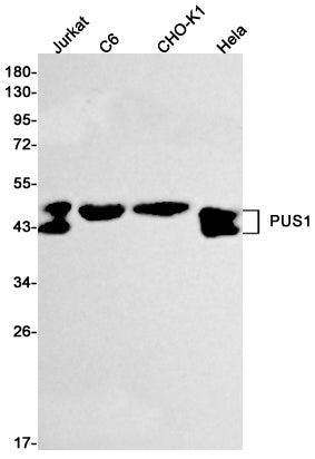 PUS1 Rabbit Monoclonal Antibody