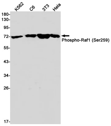 Phospho-Raf1 (Ser259) Rabbit Monoclonal Antibody