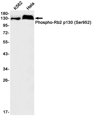Phospho-Rb2 p130 (Ser952) Rabbit Monoclonal Antibody