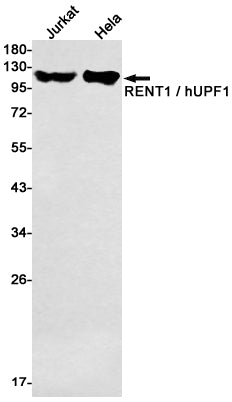 RENT1 Rabbit Monoclonal Antibody