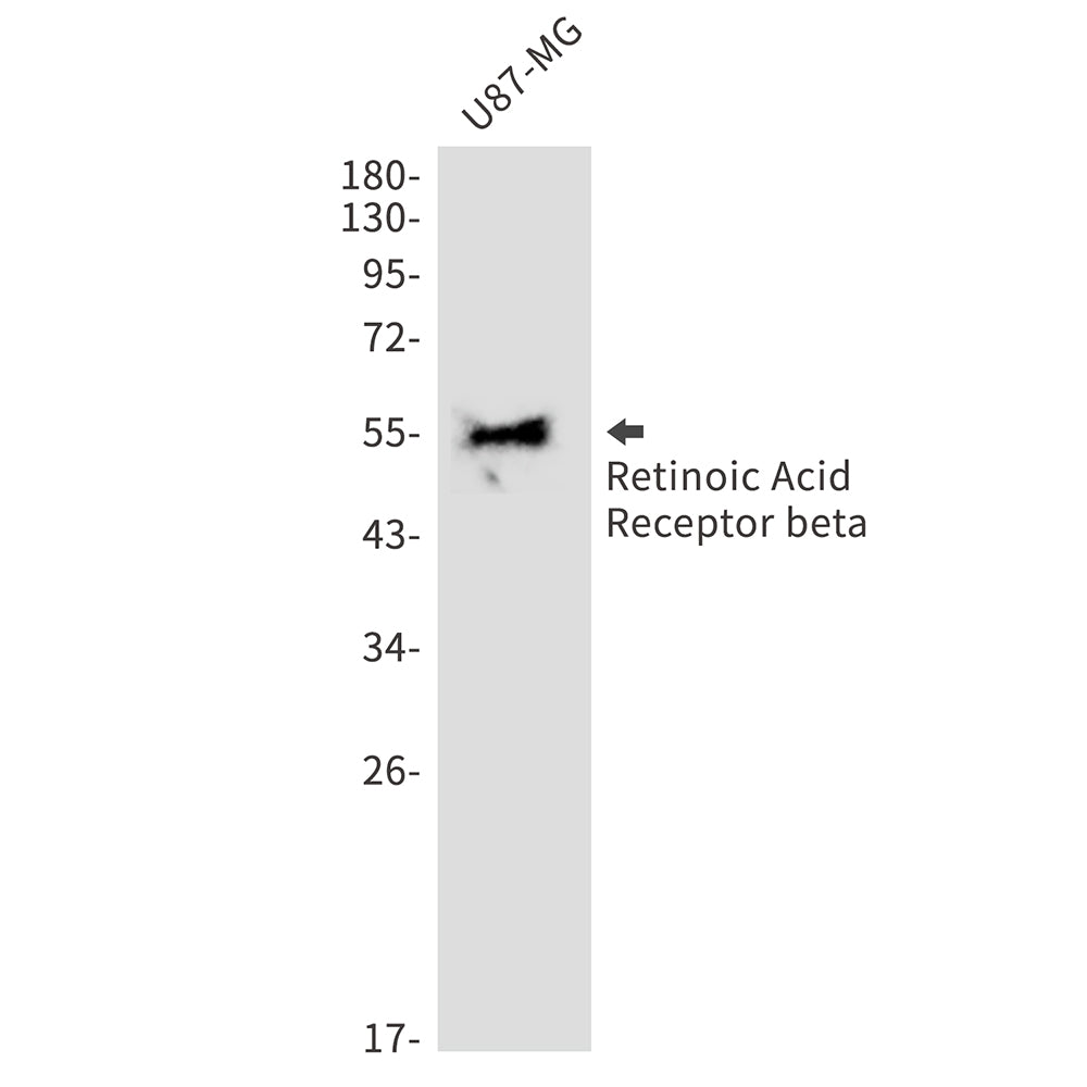 Retinoic Acid Receptor beta Rabbit Monoclonal Antibody