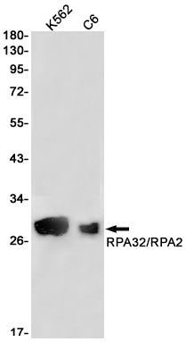 RPA32 Rabbit Monoclonal Antibody