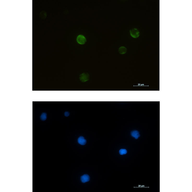 RRM2 Rabbit Monoclonal Antibody