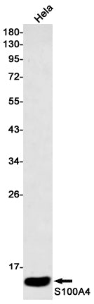 S100A4 Rabbit Monoclonal Antibody