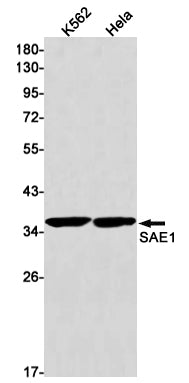 SAE1 Rabbit Monoclonal Antibody
