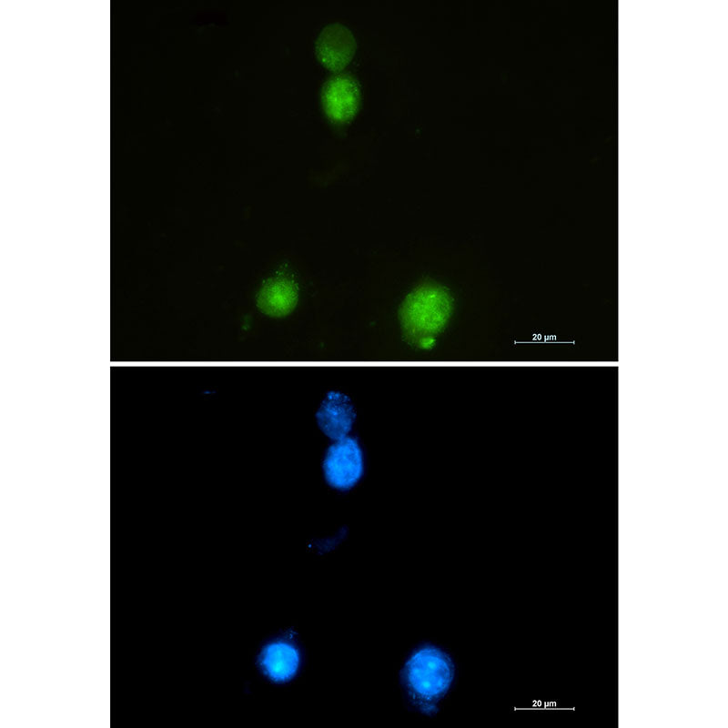 SAFB1 Rabbit Monoclonal Antibody