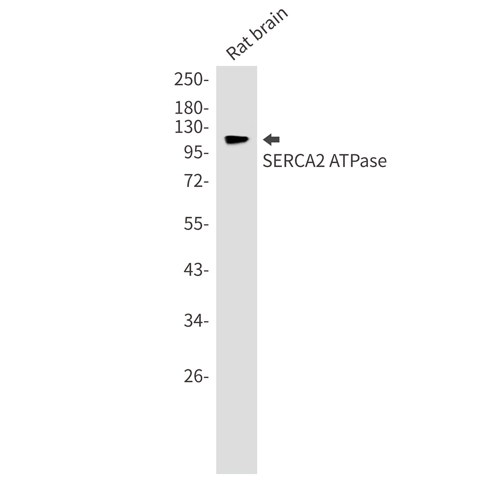 SERCA2 ATPase Rabbit Monoclonal Antibody
