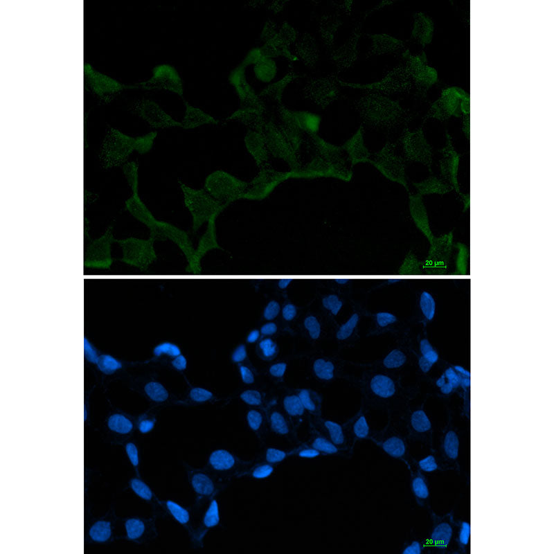 SF2 Rabbit Monoclonal Antibody