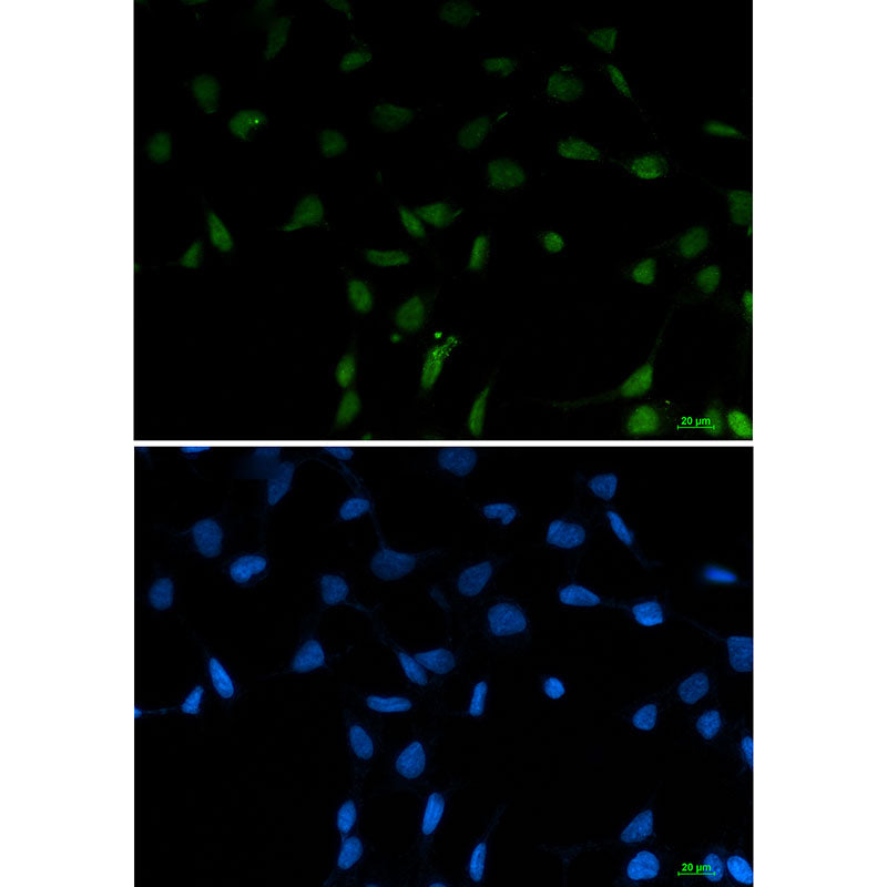 SFPQ Rabbit Monoclonal Antibody