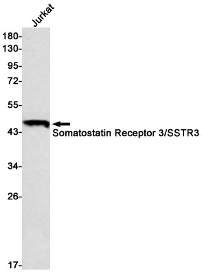 Somatostatin Receptor 3 Rabbit Monoclonal Antibody