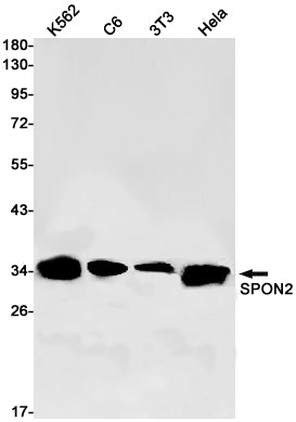 SPON2 Rabbit Monoclonal Antibody