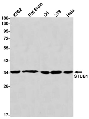 STUB1 Rabbit Monoclonal Antibody
