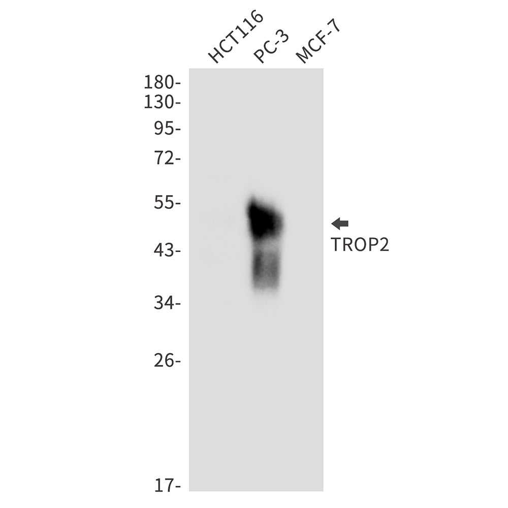 TACSTD2 Rabbit Monoclonal Antibody