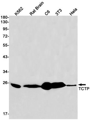 TCTP Rabbit Monoclonal Antibody